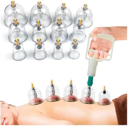 حجامة إسلامية طبية - 12 قطعة لامتصاص السموم 01145359198/01222845873